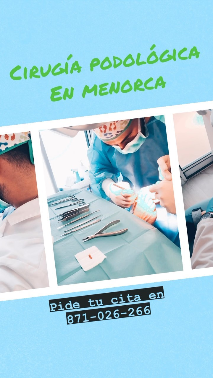 ??⚕️Cuidar los pies en verano es importante para disfrutar sin molestias. La cirugía podológica se recupera rápidamente, permitiendo volver a la normalidad en poco tiempo.
??⚕️porque unos pies sanos nos brindan comodidad y libertad en actividades al aire libre. Prevenir problemas y tratarlos a tiempo evita complicaciones mayores.
??⚕️La cirugía podológica en @florityanello es segura y efectiva, con técnicas avanzadas que reducen la recuperación. Invertir en la salud de nuestros pies mejora nuestro bienestar y movilidad. Resultados duraderos y vuelta pronta a la actividad con la cirugía podológica. Disfruta del verano con pies saludables en la playa, piscina y demás.
??⚕️ No esperes, cuida tus pies
#podologomenorca #podologomahon #podologomao #podolegmenorca #podolegmao #menorca #menorcaparadise ##mao #cirugiapodologicamenorca #cirugiamenorca #cirugiamahon #laserdiodomenorca #laserdiodomahon #lasaludempiezaporlospies
#ortopediamenorca #ortopediamahon #ortopediamao