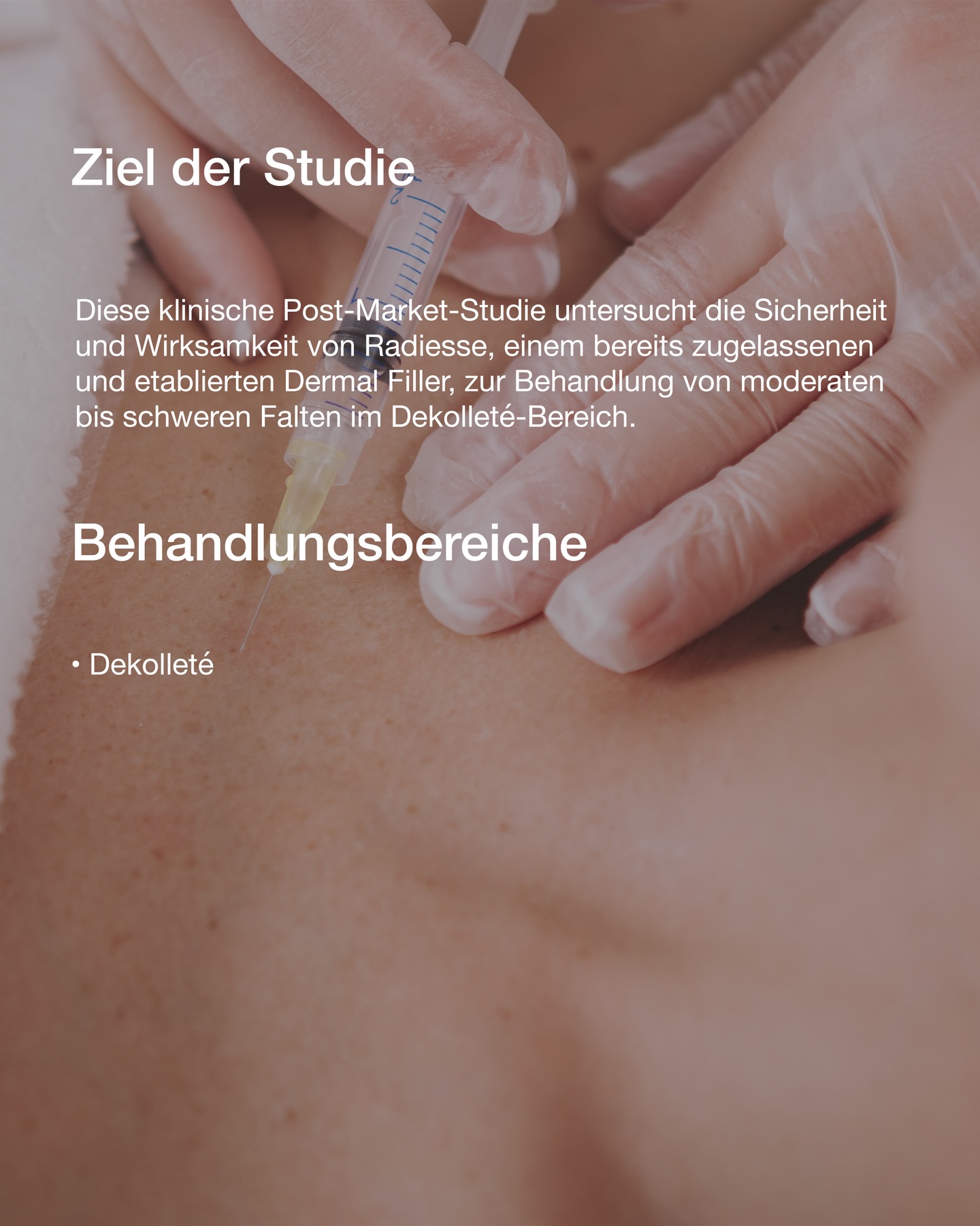 ✨ Radiesse Filler-Studie – Dekolleté ✨ Im Rahmen einer klinischen Post-Market-Studie untersuchen wir die Sicherheit und Wirksamkeit von Radiesse zur Behandlung moderater bis stark ausgeprägter Falten im Dekolleté. Teilnahme ab 18 Jahren, keine obere Altersbegrenzung. 📩 Interesse an einer Teilnahme? E-Mail an studienzentrum@noahklinik.de Betreff: Radiesse-Studie