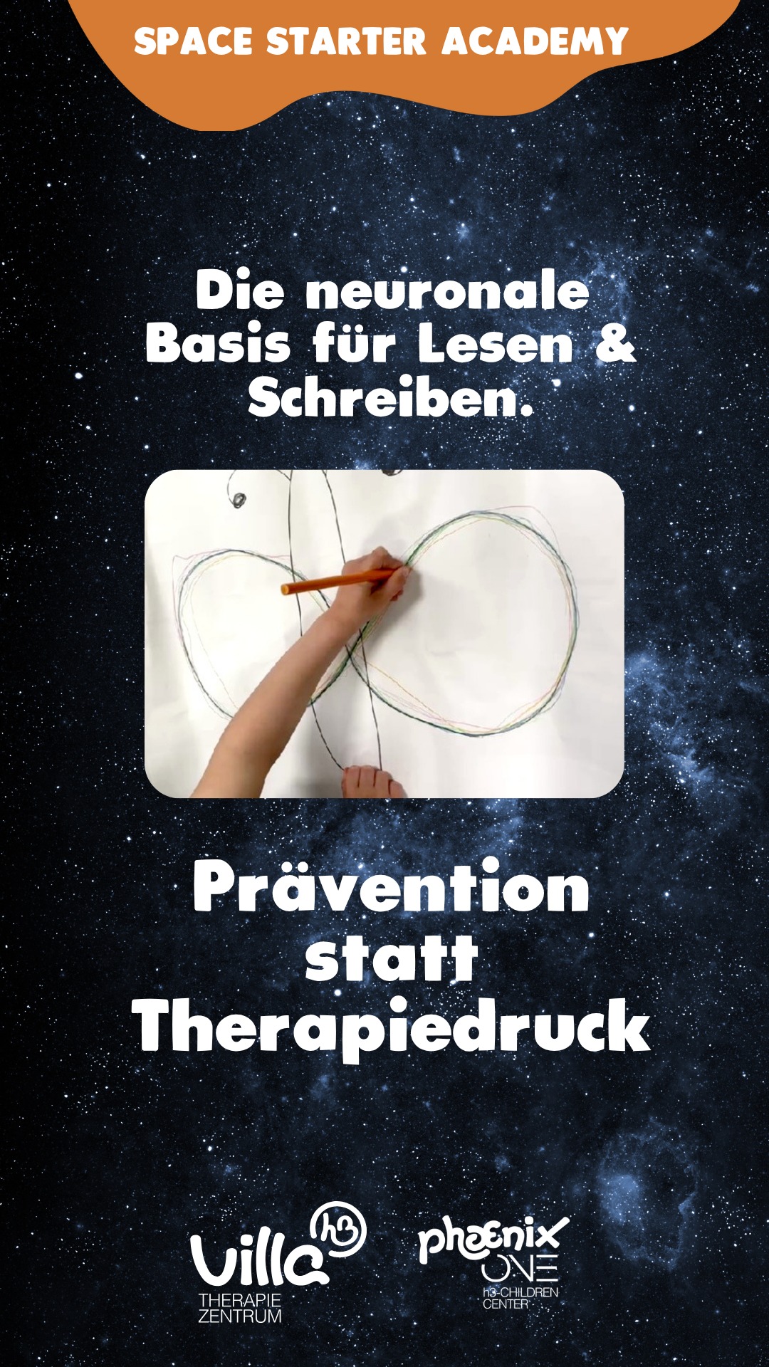 Warum wir unseren Kindern 2 Jahre Zeit geben, um schulfit zu werden – ganz ohne Druck. ♾️🚀
In unserer Space Starter Academy trainieren die „Saturns“ des phoenixONE aktuell die Mittellinienkreuzung. Was spielerisch aussieht, ist präzise neurophysiologische Vorbereitung durch die Therapeuten der Villa h3.
Die wissenschaftliche Basis: Damit komplexe Prozesse wie das Lesen- und Schreibenlernen gelingen, ist eine starke interhemisphärische Kommunikation notwendig. Das bedeutet: Die linke und rechte Gehirnhälfte müssen blitzschnell Informationen über den „Balken“ austauschen. Das Kreuzen der Körpermitte ist der effektivste Weg, diese neuronalen Autobahnen zu festigen.
Unsere Lerntherapeutin erklärt:
"Wir starten großräumig mit Schwungtüchern und landen beim präzisen Dreipunktgriff. Der Stift liegt dabei entspannt wie im ‚Sonnenstuhl‘ zwischen Daumen und Zeigefinger. So ermöglichen wir feine Shiftbewegungen ohne Verkrampfen – die Basis für ein lockeres Schriftbild."
Der h3-Vorteil: Zeit statt Druck
Durch die Kooperation von Kindergarten und Therapiezentrum setzen wir bereits zwei Jahre vor der Einschulung an:
✅ Frühzeitige Diagnostik: Händigkeit und Motorik werden direkt vor Ort gecheckt.
✅ Individuelles Tempo: Jedes Kind meistert Entwicklungsschritte ohne „Vorschulstress“.
✅ Fundierte Empfehlung: Am Ende steht ein klarer Fahrplan für einen sicheren Schulstart.
Ein starkes Netzwerk für starke Kinder. 🤝✨
#SpaceStarterAcademy #VillaH3 #phoenixONE #Vorschule #Lerntherapie #Schulfähigkeit #Mittellinienkreuzung #Dreipunktgriff #InterhemisphärischeKommunikation #Prävention #OelsnitzErzgebirge
music: India_Happy